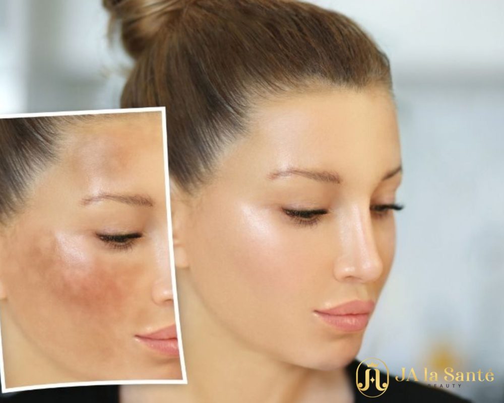 Melanin là sắc tố quyết định màu sắc của da, tóc, và mắt